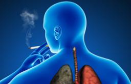 بیماری انسدادی مزمن ریه: تاکید بر موکولیتیک ها درمان تشدید COPD مقالات علمی جدید