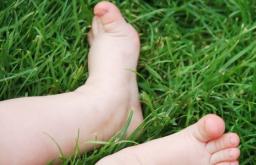 چگونه صافی کف پا را در خانه درمان کنیم آیا می توان صافی کف پای کودک را درمان کرد؟
