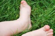 كيفية علاج القدم المسطحة في المنزل هل من الممكن علاج القدم المسطحة عند الطفل