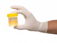 Tester për të varur nga droga nga urina