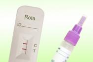 چه آزمایش هایی برای عفونت روتا ویروس داده می شود: انواع و هزینه