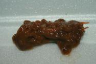 Pinworms في البراز - من أين يأتي الطفيلي في الجسم ، كيف تبدو