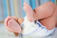 علل توده ها در نوزادان شیرده