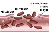 الصفائح الدموية: القاعدة وعلم الأمراض ، آليات الإرقاء وتجلط الدم ، وعلاج الاضطرابات